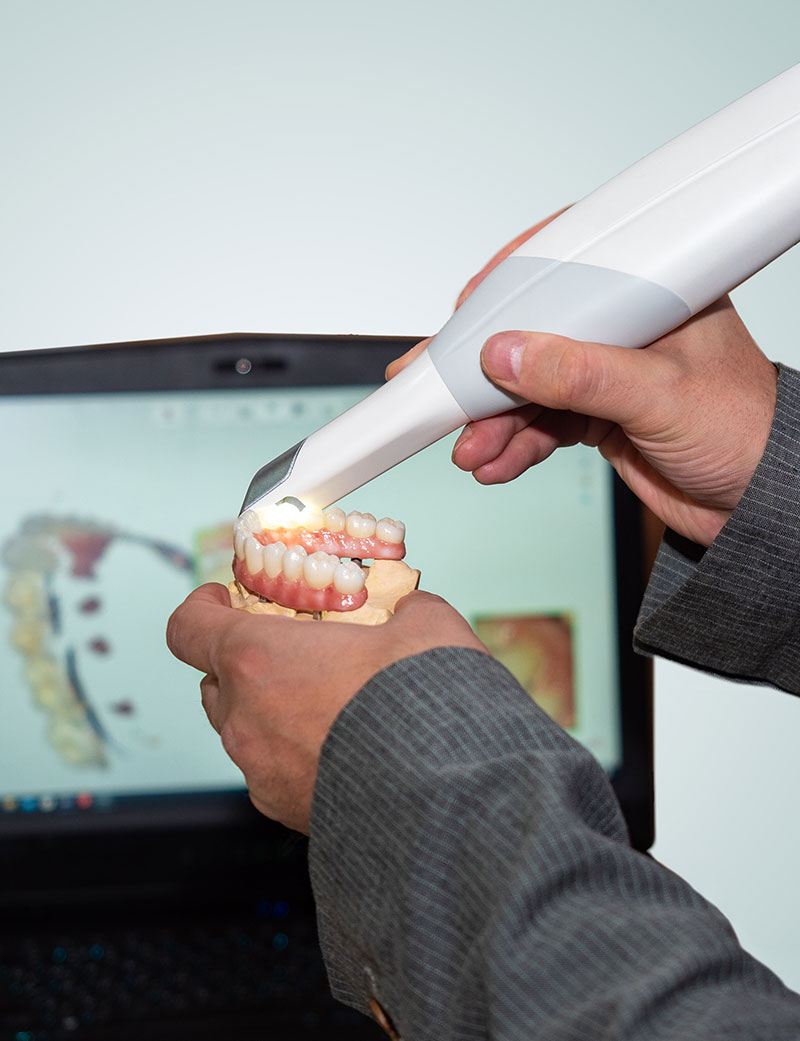 Mani del dentista con scanner intraorale su mockup denti